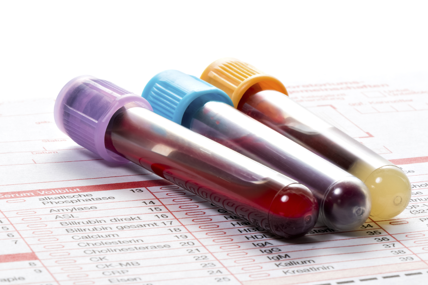 آموزش خواندن برگه آزمایش خون + جدول